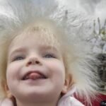 O que é a síndrome do cabelo impenteável: 'o cabelo da minha filha é lindo'