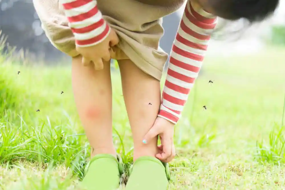 criança coçando a pele e mosquitos picando